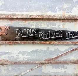 Tattoos removed&period;&period;&period;: Click Here To View Larger Image